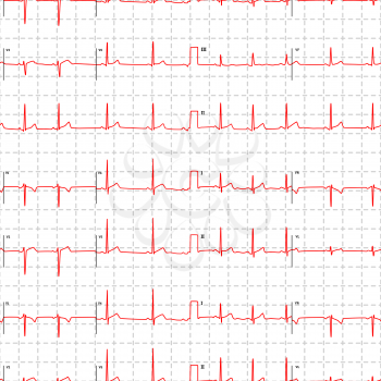 Typical human electrocardiogram red graph with marks on white, seamless pattern