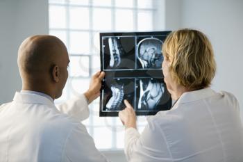 Male and female doctor looking at patient xray film.