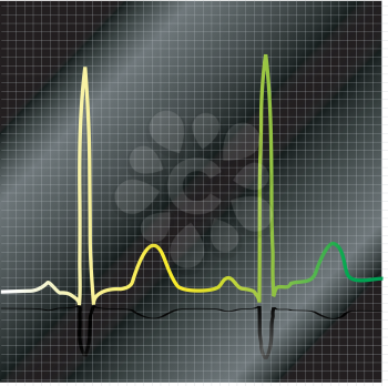 Royalty Free Clipart Image of a ECG Graph
