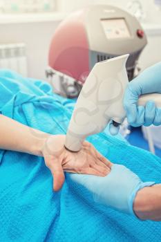 Procedure for palm against hyperhidrosis