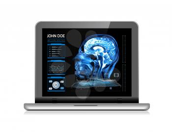 Notebook monitor with medical MRI and other real-time analyzes. Medicine of the future. Vector illustration on white background