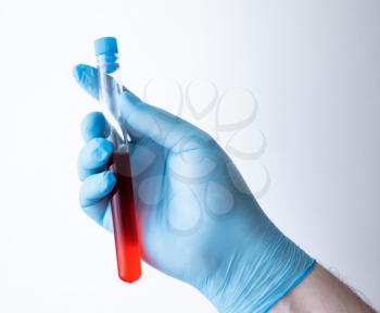 A doctor in blue disposable latex gloves is holding a test tube with a blood sample.