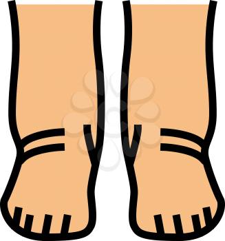 feet edema health disease color icon vector. feet edema health disease sign. isolated symbol illustration