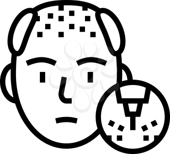 baldness disease line icon vector. baldness disease sign. isolated contour symbol black illustration