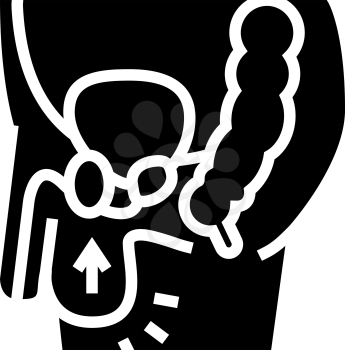 cryptorchidism disease line icon vector. cryptorchidism disease sign. isolated contour symbol black illustration
