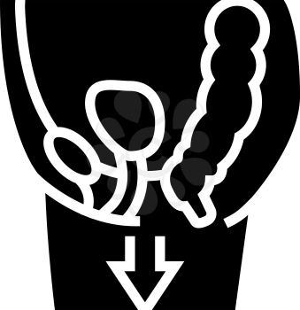 organ prolapse disease line icon vector. organ prolapse disease sign. isolated contour symbol black illustration