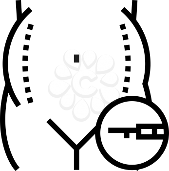 liposuction surgery line icon vector. liposuction surgery sign. isolated contour symbol black illustration