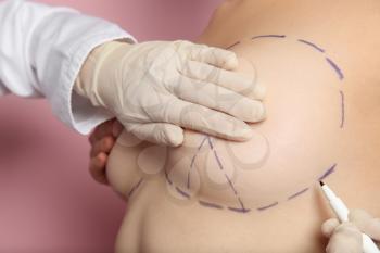 Doctor drawing marks on female breast before cosmetic surgery operation against color background�