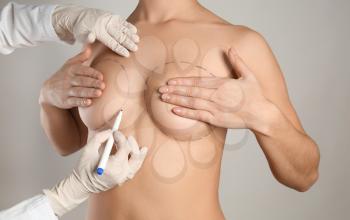 Doctor drawing marks on female breast before cosmetic surgery operation against grey background�