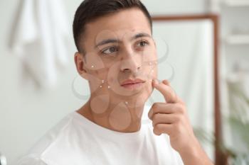 Portrait of young man using remedy for acne at home�