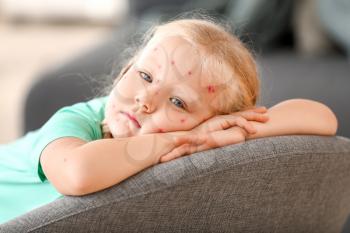 Little girl ill with chickenpox at home�