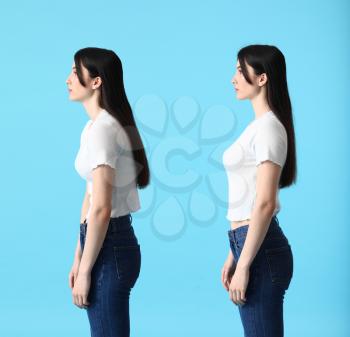 Young woman with bad and proper posture on color background�
