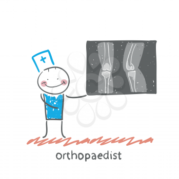 orthopaedist shows an X-ray