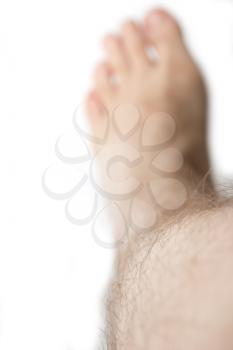 hairy skin feet