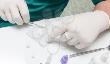 A dentist prepares an implant in the clinic .