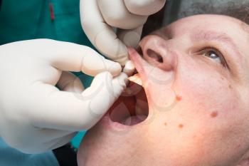 The dentist works with the client in the clinic .