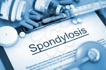 Diagnosis - Spondylosis On Background of Medicaments Composition - Pills, Injections and Syringe. Spondylosis, Medical Concept with Pills, Injections and Syringe. 3D Render.