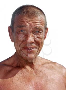 tanned tanned older man with wrinkles and skin problems