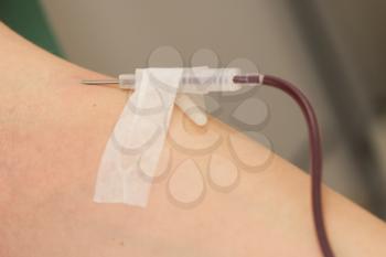 Donor in an armchair donates blood at hemotransfusion station, close-up