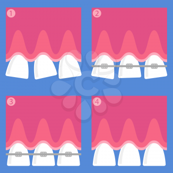 Medical Braces Teeth. Dental Care Background. Orthodontic Treatment. Cartoon Opening Mouth.