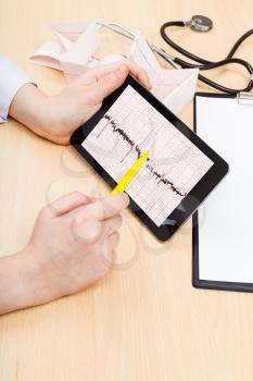 doctor checks patient electrocardiogram on tablet pc