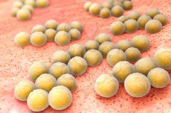 Staphylococcus aureus