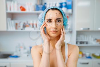 Female patient with markers on her face, cosmetician's office. Rejuvenation procedure in beautician salon. Cosmetic surgery against wrinkles, preparation to botox