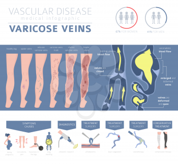 Vascular diseases. Varicose veins symptoms, treatment icon set. Medical infographic design. Vector illustration