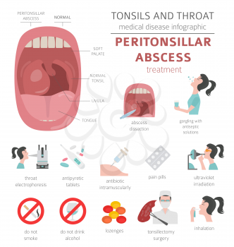 Tonsils and throat diseases. Peritonsillar abscess symptoms, treatment icon set. Medical infographic design. Vector illustration