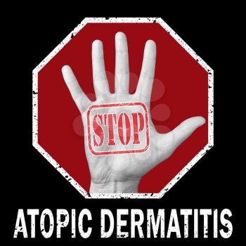 Stop atopic dermatitis conceptual illustration. Open hand with the text stop atopic dermatitis. Dermatological Diseases