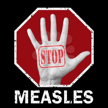 Stop measles conceptual illustration. Open hand with the text stop measles. Global social problem
