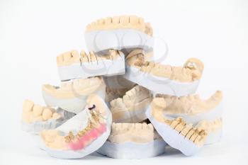 plaster model of teeth