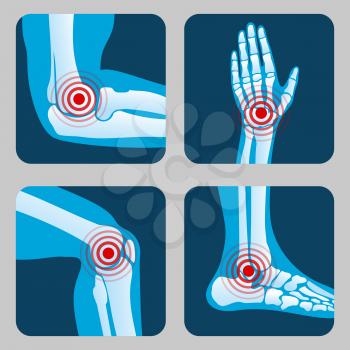Human joints with pain rings. Arthritis and rheumatism infographic. Medical app vector buttons. Disease in joint bone, knee, leg and hand illustration