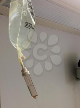 iv intravenous drip attached to solution medicine plastic bag