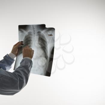 Royalty Free Photo of a Male Doctor Pointing at an X-ray