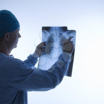Royalty Free Photo of a Male Doctor Looking at an X-Ray
