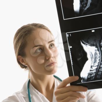 Royalty Free Photo of a Female Doctor Analyzing an X-ray