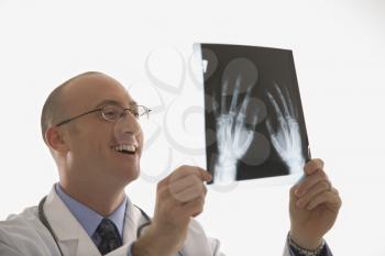 Royalty Free Photo of a Physician Holding Up Hand X-Rays