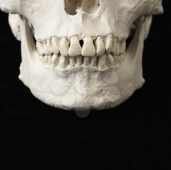 Royalty Free Photo of a Close-up of Human Teeth on a Skull