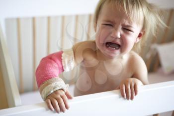 Royalty Free Photo of a Baby Girl With a Broken Arm