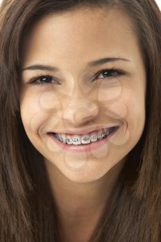 Royalty Free Photo of a Young Girl in Braces