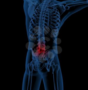 3D render of a medical skeleton illustrating back pain