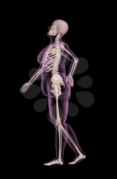 3D render of an overweight female medical skeleton with back pain
