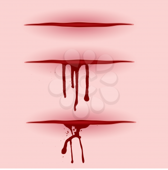 Royalty Free Clipart Image of Three Open Wounds