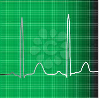 Royalty Free Clipart Image of an ECG Monitor