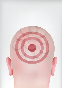 Target Head 