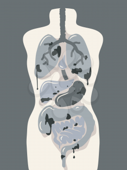 Illustration Featuring a Dummy Showing Damaged Internal Organs
