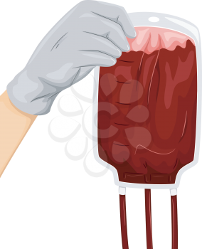 Illustration of a Hand Covered by a Surgical Glove Holding a Bag of Blood