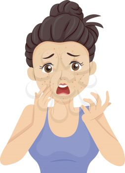 Illustration of a Teenage Girl Having a Pimple Breakout