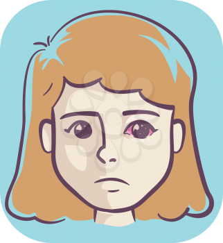 Illustration of Girl with Pink Eye, a Gonorrhea Symptom